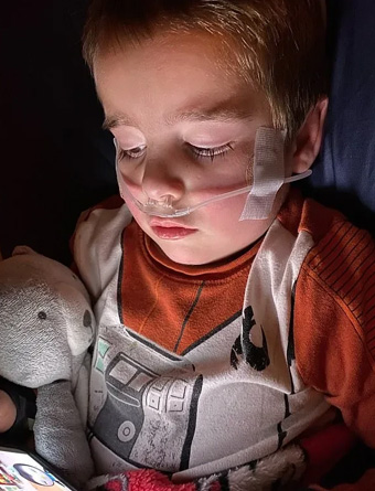 中医治疗儿童重症感冒