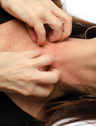 中医有效治疗全身异常瘙痒